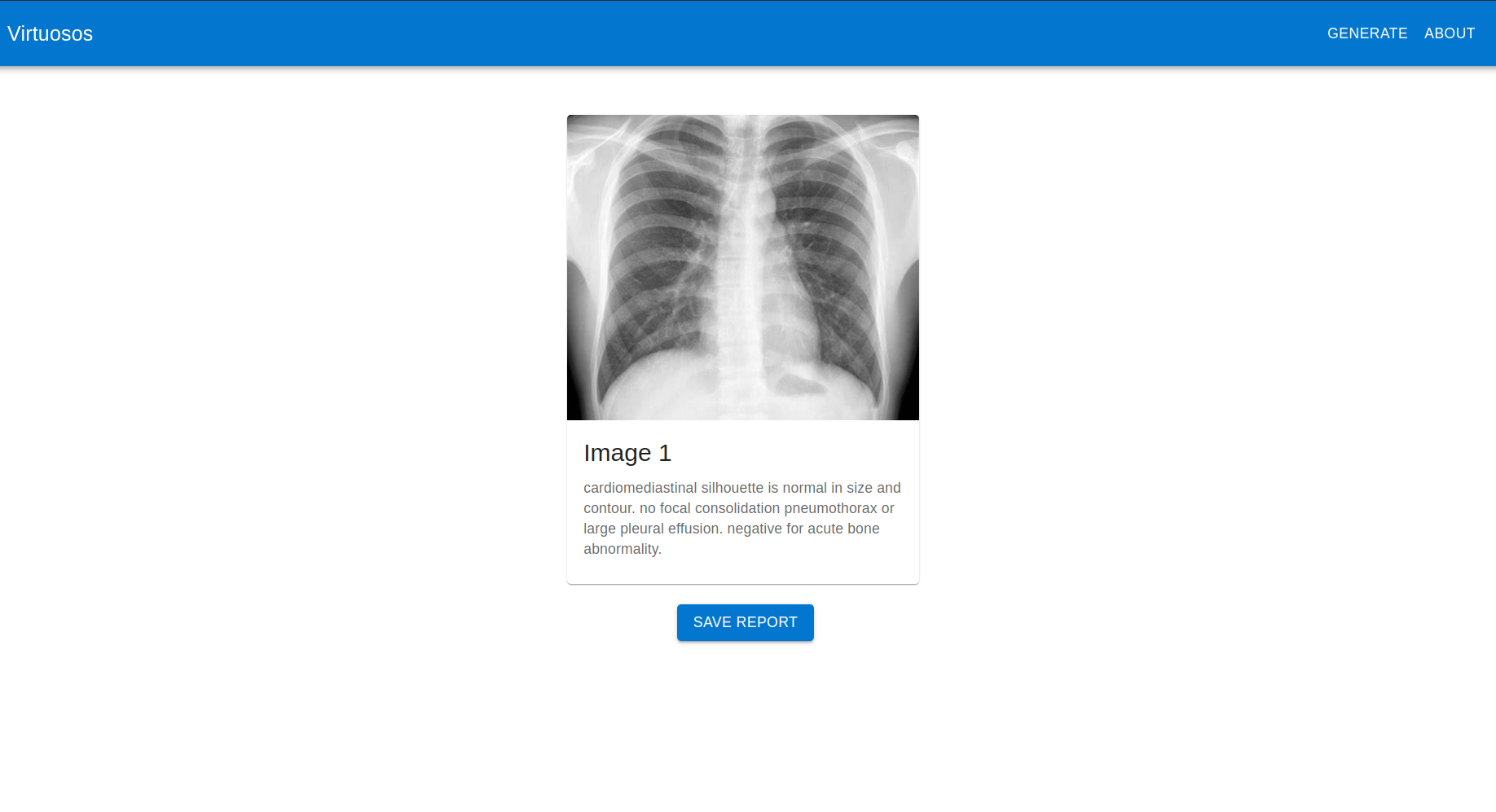 Medical Image Captioning